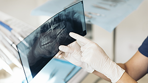 Analyse d’une radiographie dentaire pour un diagnostic